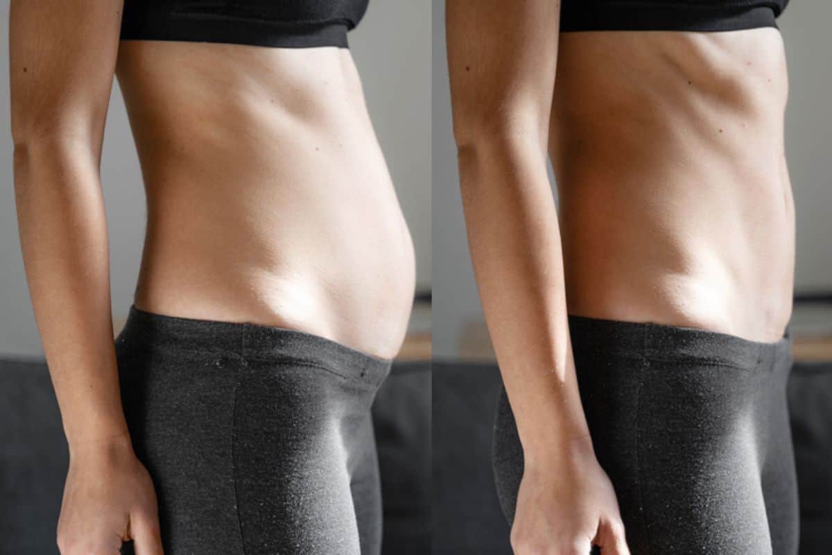 Post-Pregnancy: What Happens to Your Abdominal Muscles After Birth Kingston upon Thames