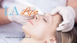 Woman receiving Actinic Keratosis Removal Treatment Kingston upon Thames