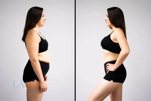 LA-EMS Body Sculpting Kingston upon Thames results before and after of womans results on body toning.