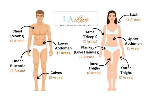 LA LIPO Cryolipolysis Areas Kingston upon Thames