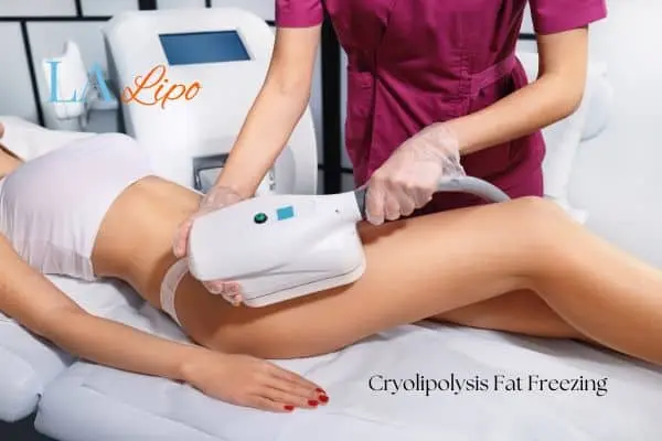 Woman receiving coolsculpting Kingston upon Thames treatment on her thighs