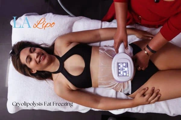 woman getting cryolipolysis Kingston upon Thames