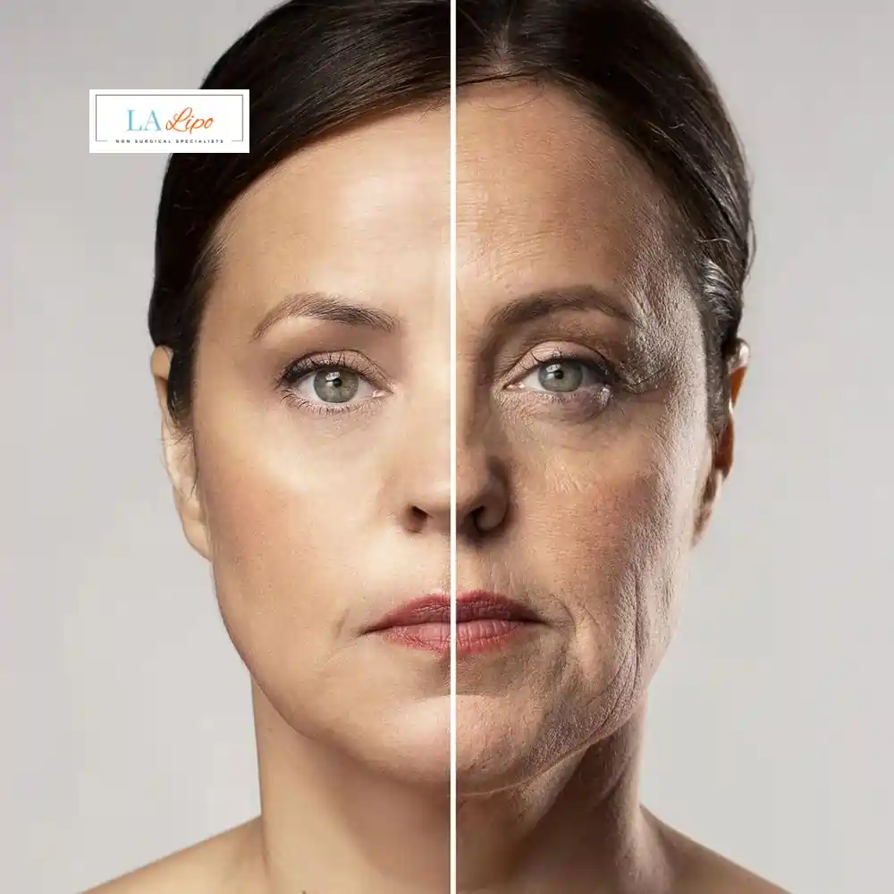 How Can You Tell If Non-Surgical Skin Tightening Is Right for You Kingston upon Thames?