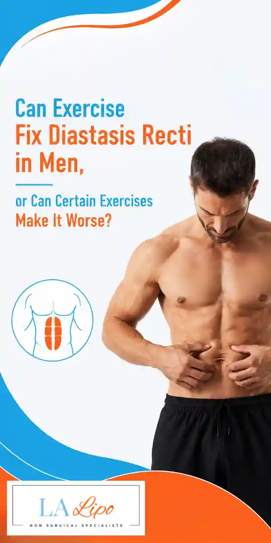 Can Exercise Fix Diastasis Recti in Men, or Can Certain Exercises Make It Worse Kingston upon Thames?