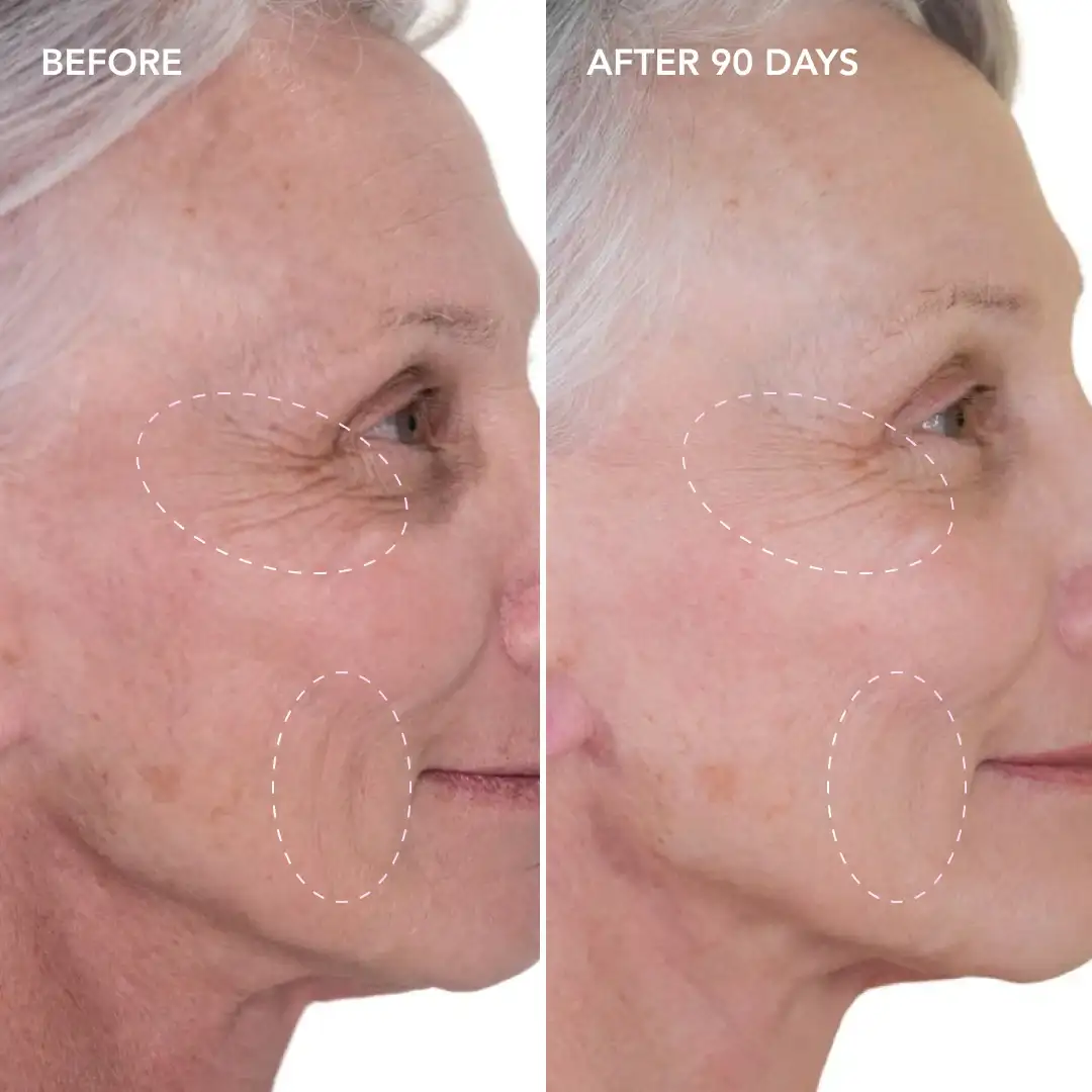 When will you see results Kingston upon Thames